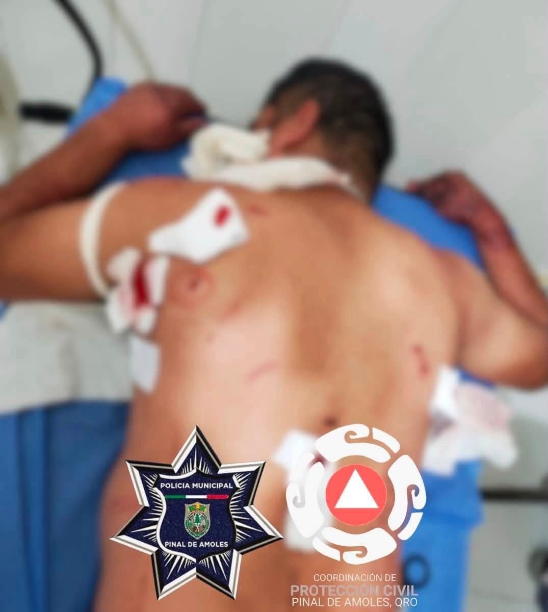 Discusión familiar termina con un hombre herido por arma blanca en Pinal de Amoles