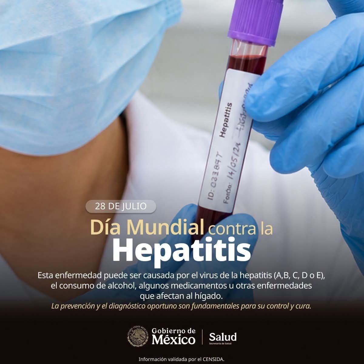 Ojos y piel amarilla: las señales de alerta por hepatitis que no debes ignorar